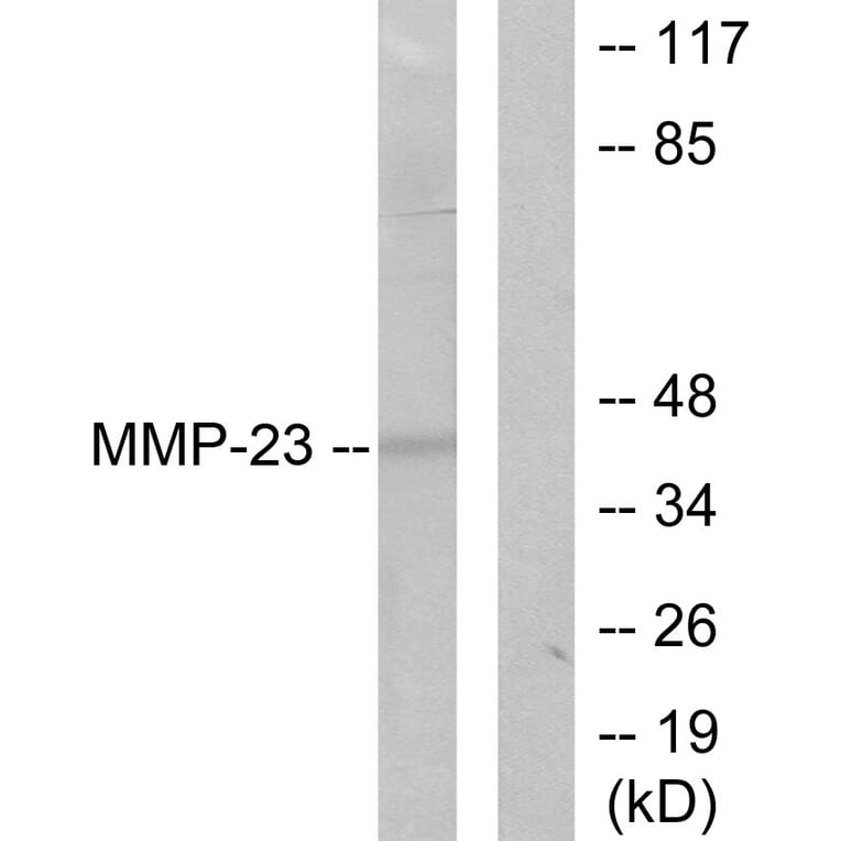 Western Blot - Anti-MMP-23 Antibody (C0271) - Antibodies.com