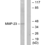 Western Blot - Anti-MMP-23 Antibody (C0271) - Antibodies.com