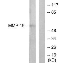 Western Blot - Anti-MMP-19 Antibody (C0269) - Antibodies.com