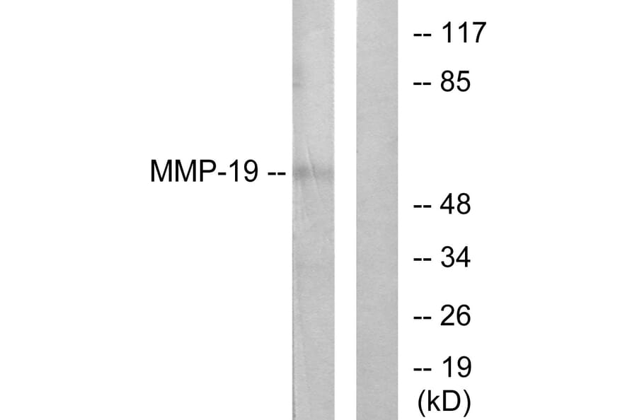 Western Blot - Anti-MMP-19 Antibody (C0269) - Antibodies.com