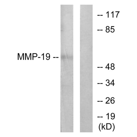 Western Blot - Anti-MMP-19 Antibody (C0269) - Antibodies.com