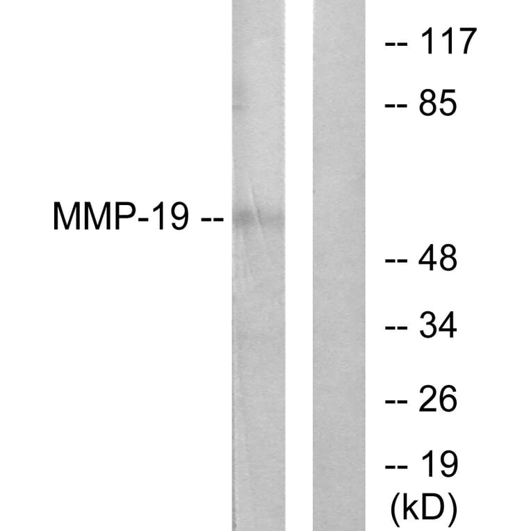 Western Blot - Anti-MMP-19 Antibody (C0269) - Antibodies.com
