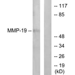 Western Blot - Anti-MMP-19 Antibody (C0269) - Antibodies.com