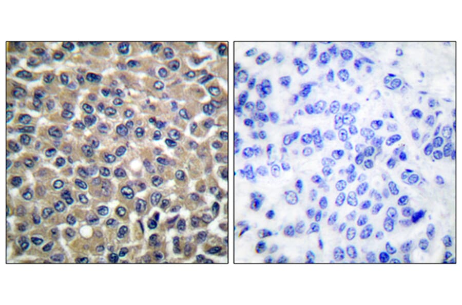 Immunohistochemistry - Anti-MMP-19 Antibody (C0269) - Antibodies.com
