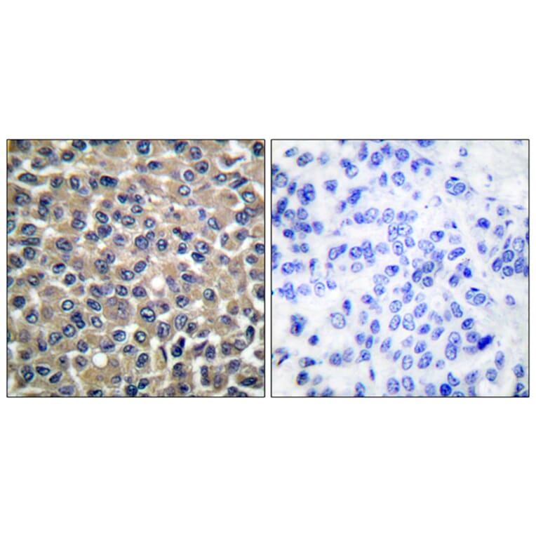 Immunohistochemistry - Anti-MMP-19 Antibody (C0269) - Antibodies.com