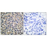 Immunohistochemistry - Anti-MMP-19 Antibody (C0269) - Antibodies.com