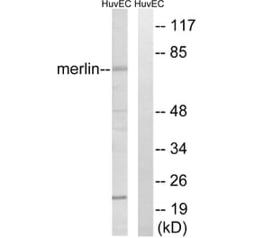 Western Blot - Anti-Merlin Antibody (B7150) - Antibodies.com