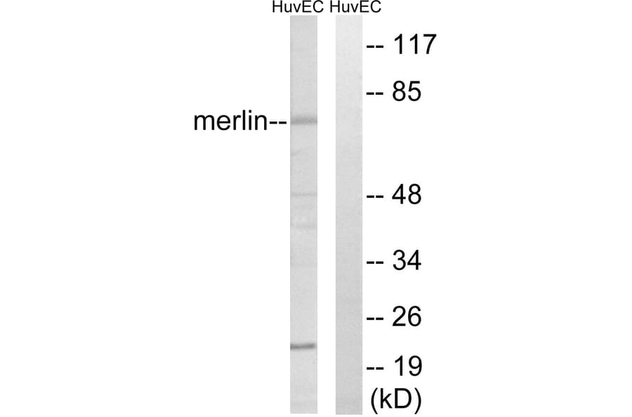 Western Blot - Anti-Merlin Antibody (B7150) - Antibodies.com
