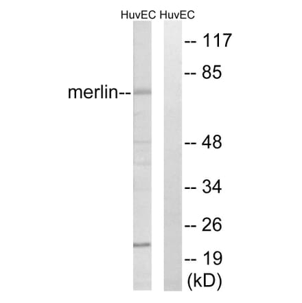 Western Blot - Anti-Merlin Antibody (B7150) - Antibodies.com