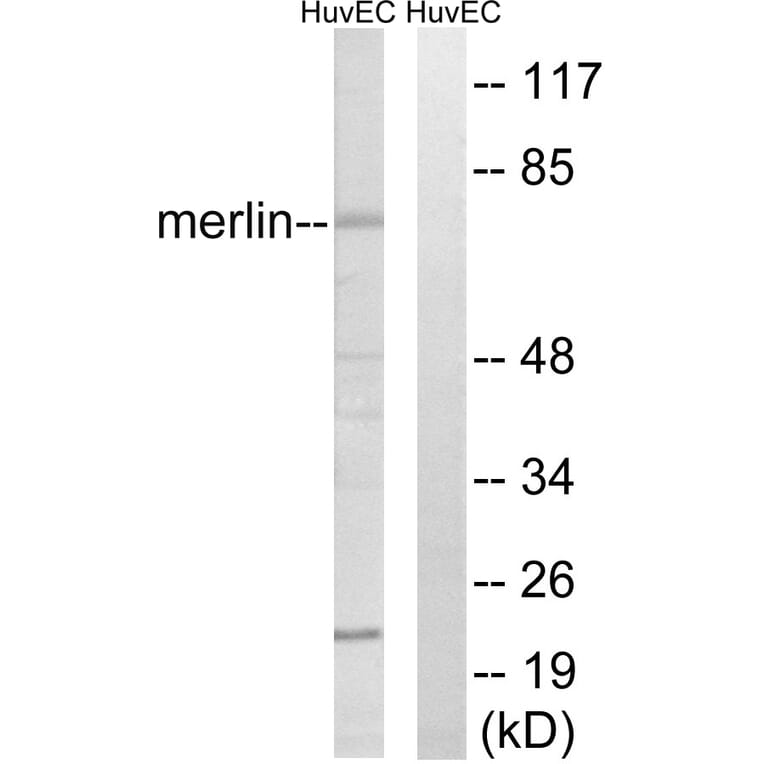 Western Blot - Anti-Merlin Antibody (B7150) - Antibodies.com