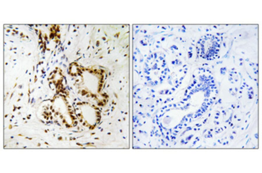 Immunohistochemistry - Anti-Merlin Antibody (B7150) - Antibodies.com