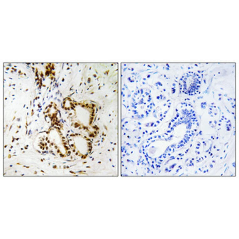 Immunohistochemistry - Anti-Merlin Antibody (B7150) - Antibodies.com