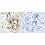 Immunohistochemistry - Anti-Merlin Antibody (B7150) - Antibodies.com