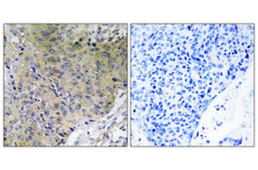 Immunohistochemistry - Anti-Merlin Antibody (B7150) - Antibodies.com