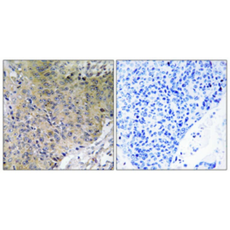 Immunohistochemistry - Anti-Merlin Antibody (B7150) - Antibodies.com