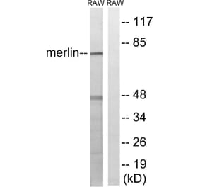 Western Blot - Anti-Merlin Antibody (B8046) - Antibodies.com