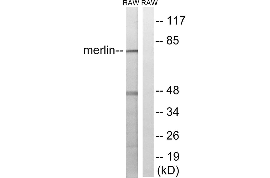 Western Blot - Anti-Merlin Antibody (B8046) - Antibodies.com