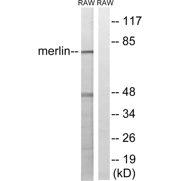 Western Blot - Anti-Merlin Antibody (B8046) - Antibodies.com