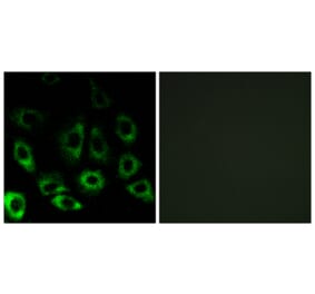 Immunofluorescence - Anti-MBTPS2 Antibody (C16618) - Antibodies.com