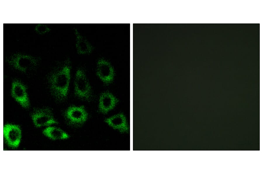 Immunofluorescence - Anti-MBTPS2 Antibody (C16618) - Antibodies.com