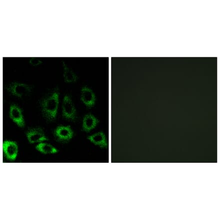 Immunofluorescence - Anti-MBTPS2 Antibody (C16618) - Antibodies.com