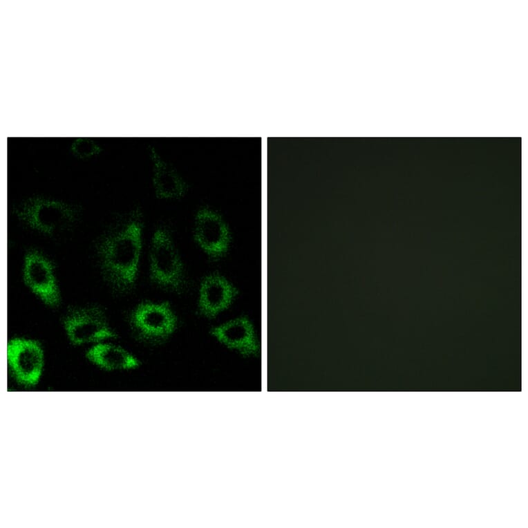 Immunofluorescence - Anti-MBTPS2 Antibody (C16618) - Antibodies.com