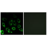 Immunofluorescence - Anti-MBTPS2 Antibody (C16618) - Antibodies.com