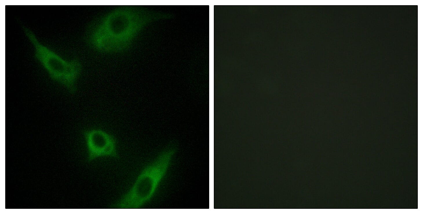 Immunofluorescence analysis of HeLa cells using Anti-MAP3K1 Antibody. The right hand panel represents a negative control, where the antibody was pre-incubated with the immunising peptide.