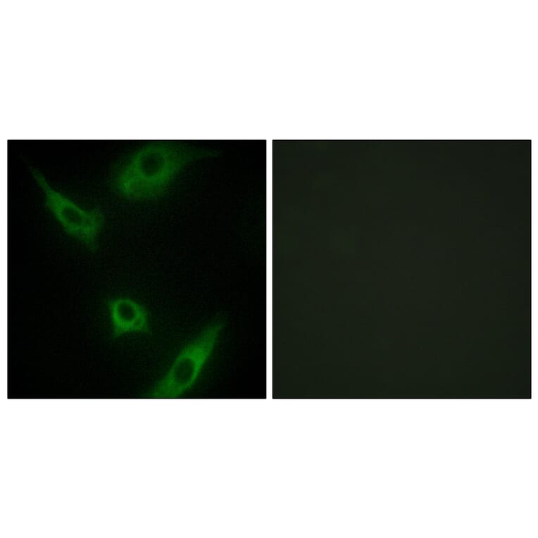 Immunofluorescence - Anti-MAP3K1 Antibody (C10960) - Antibodies.com