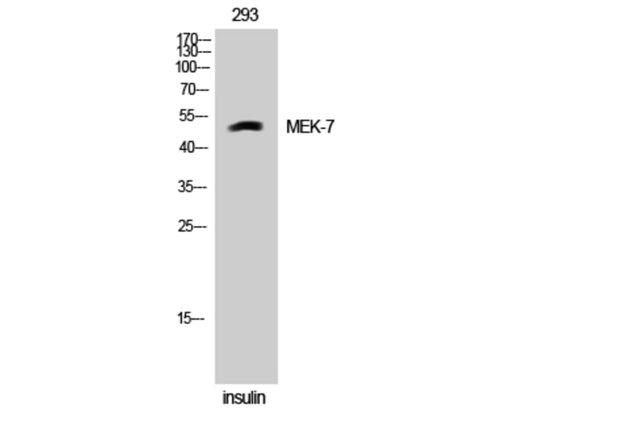 Western Blot - Anti-MAP2K7 Antibody (B8141) - Antibodies.com