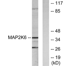 Western Blot - Anti-MAP2K6 Antibody (C10699) - Antibodies.com