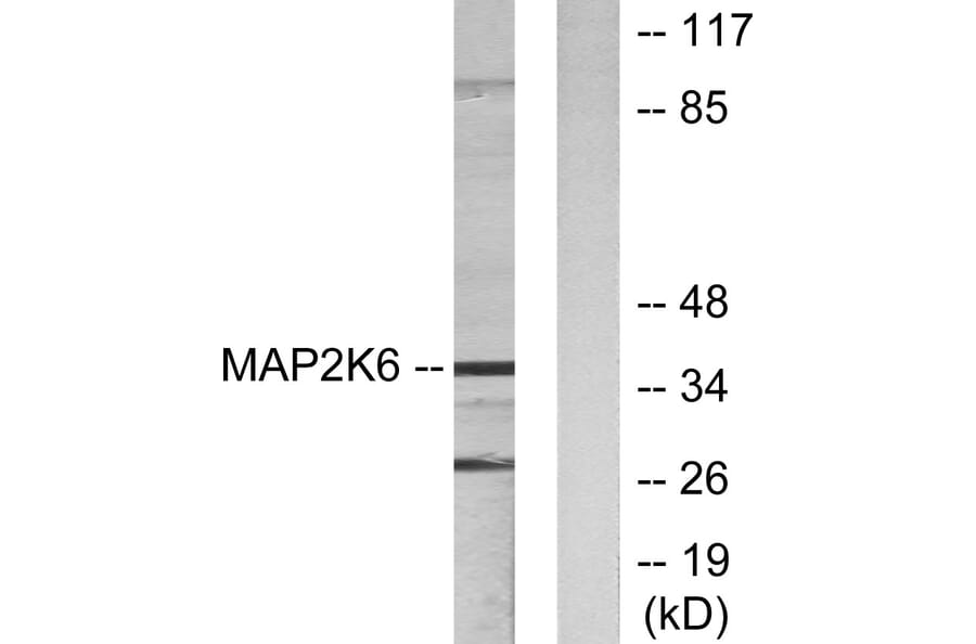 Western Blot - Anti-MAP2K6 Antibody (C10699) - Antibodies.com