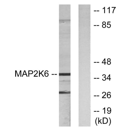 Western Blot - Anti-MAP2K6 Antibody (C10699) - Antibodies.com