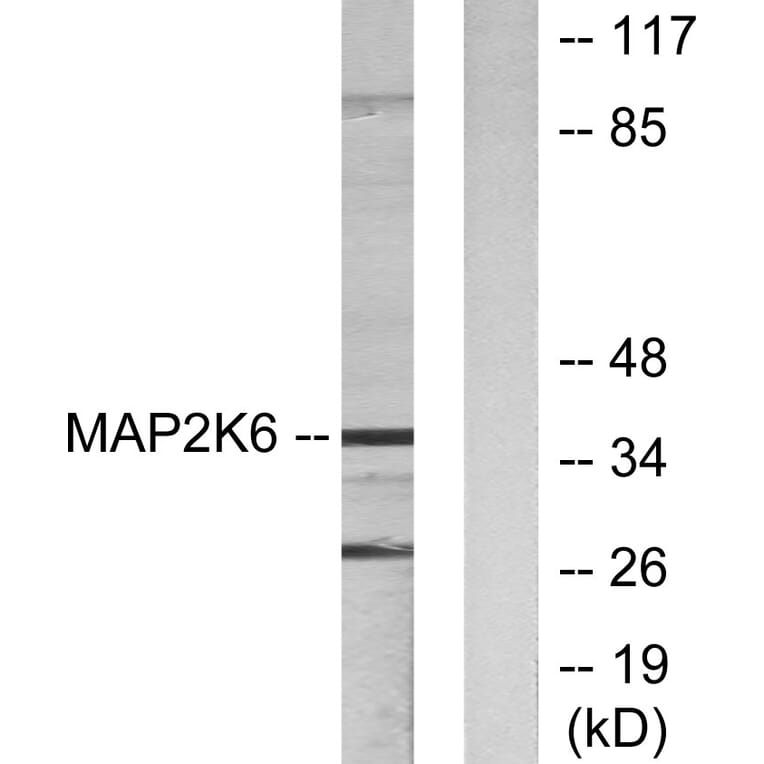 Western Blot - Anti-MAP2K6 Antibody (C10699) - Antibodies.com