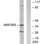 Western Blot - Anti-MAP2K6 Antibody (C10699) - Antibodies.com