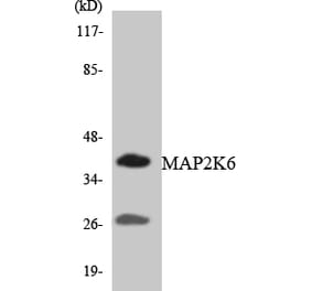 Western Blot - Anti-MAP2K6 Antibody (R12-2989) - Antibodies.com