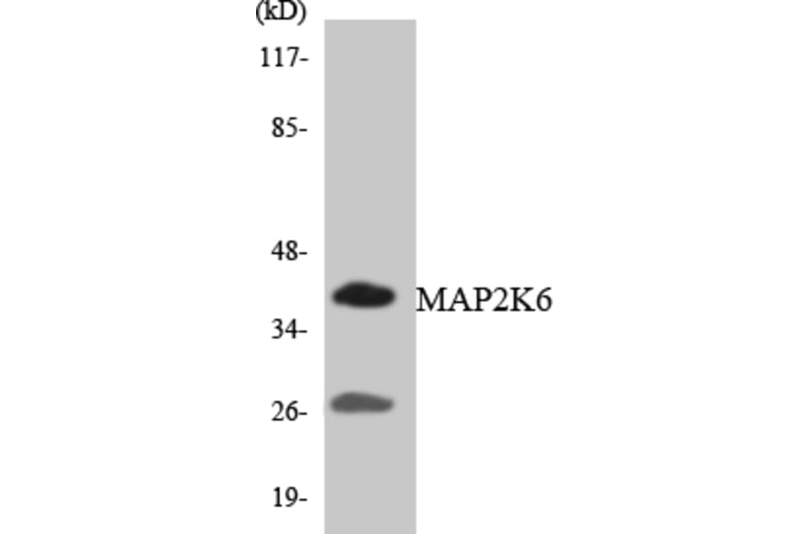Western Blot - Anti-MAP2K6 Antibody (R12-2989) - Antibodies.com