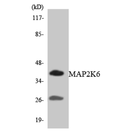 Western Blot - Anti-MAP2K6 Antibody (R12-2989) - Antibodies.com