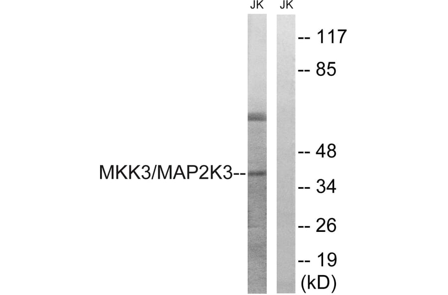 Western Blot - Anti-MAP2K3 Antibody (B8139) - Antibodies.com