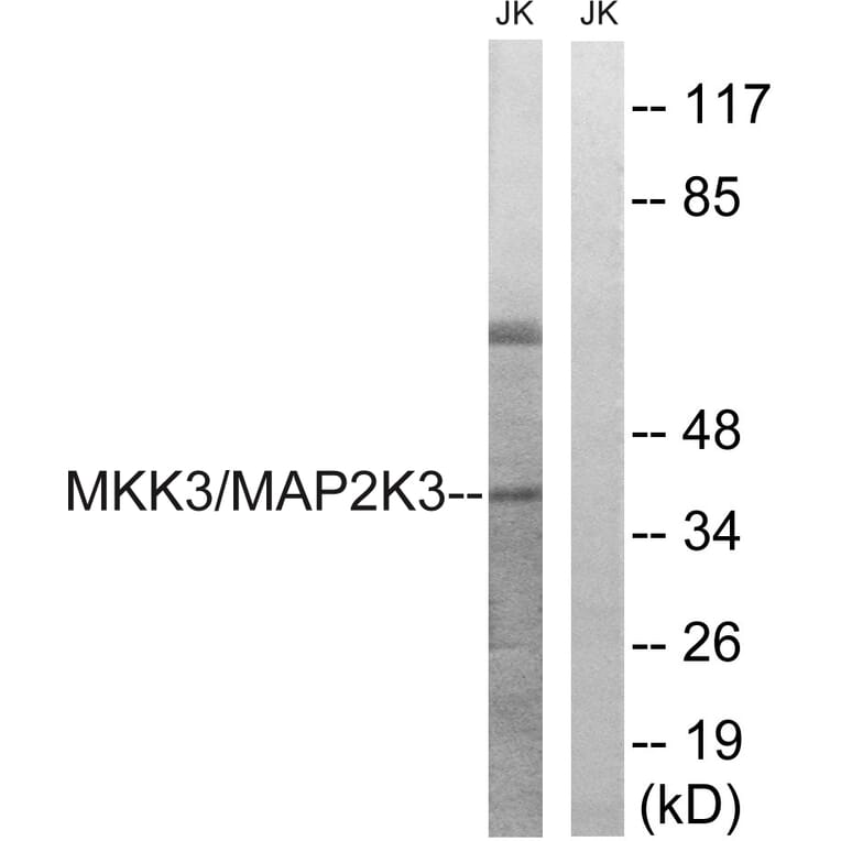 Western Blot - Anti-MAP2K3 Antibody (B8139) - Antibodies.com