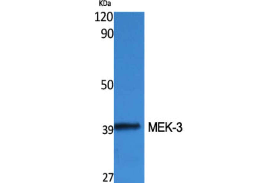 Western Blot - Anti-MAP2K3 Antibody (B8139) - Antibodies.com