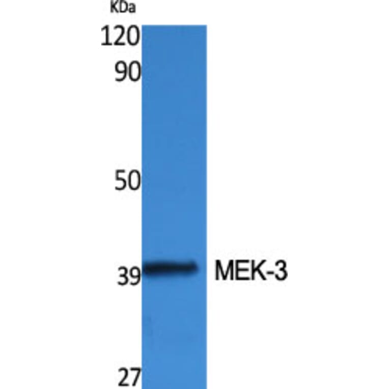 Western Blot - Anti-MAP2K3 Antibody (B8139) - Antibodies.com