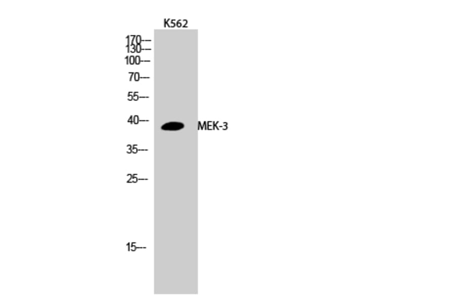 Western Blot - Anti-MAP2K3 Antibody (B8139) - Antibodies.com
