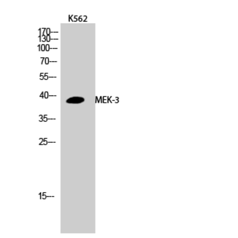 Western Blot - Anti-MAP2K3 Antibody (B8139) - Antibodies.com