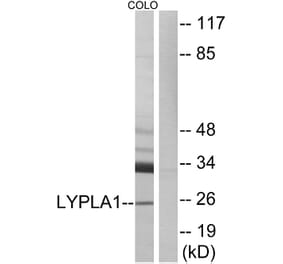 Western Blot - Anti-LYPLA1 Antibody (C14279) - Antibodies.com
