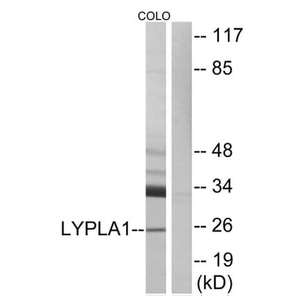 Western Blot - Anti-LYPLA1 Antibody (C14279) - Antibodies.com