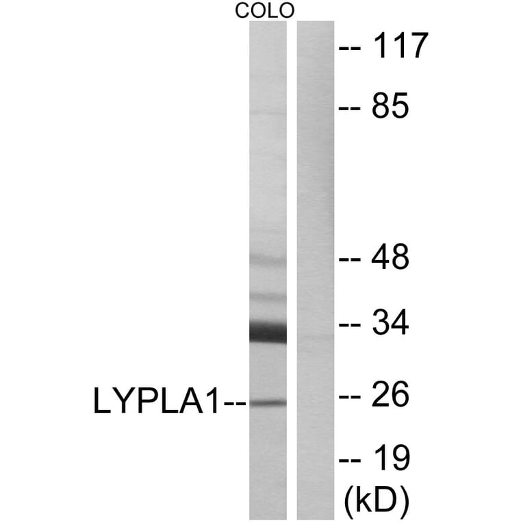 Western Blot - Anti-LYPLA1 Antibody (C14279) - Antibodies.com