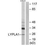 Western Blot - Anti-LYPLA1 Antibody (C14279) - Antibodies.com