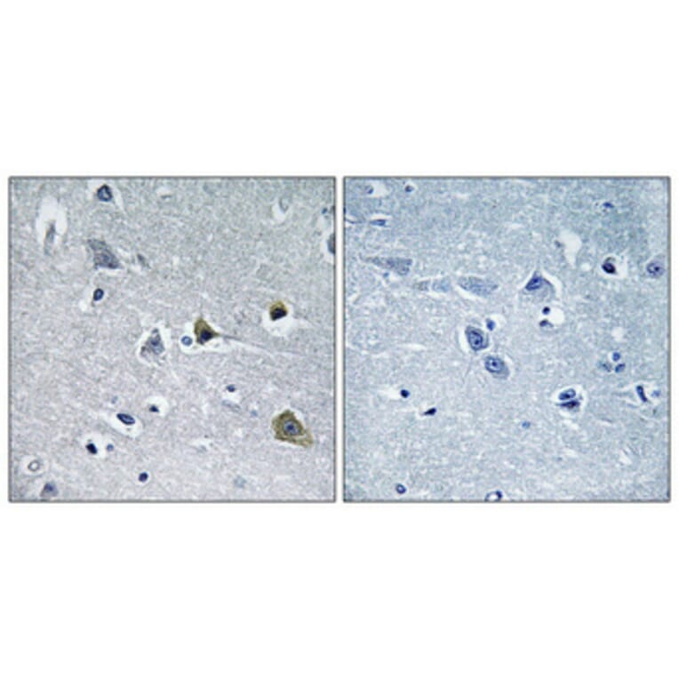Immunohistochemistry - Anti-LYPLA1 Antibody (C14279) - Antibodies.com