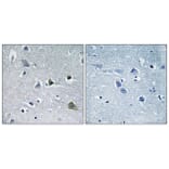 Immunohistochemistry - Anti-LYPLA1 Antibody (C14279) - Antibodies.com